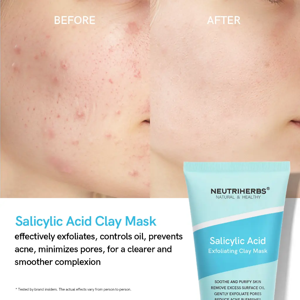 Salicylic acid clay mask-11.webp